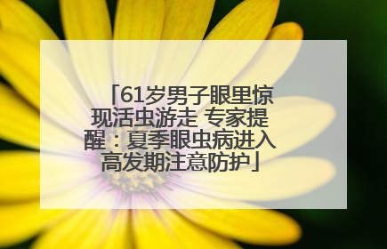 61岁男子眼里惊现活虫游走 专家提醒：夏季眼虫病进入高发期注意防护